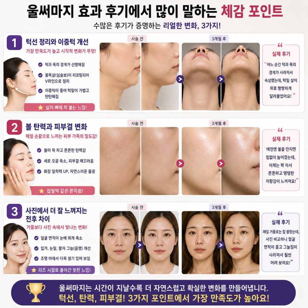 울써마지 시술 후 턱선 정리, 이중턱 개선, 피부 탄력, 피부결 변화와 사진 속 전후 차이를 실사 비교로 보여주는 후기 중심 인포그래픽.