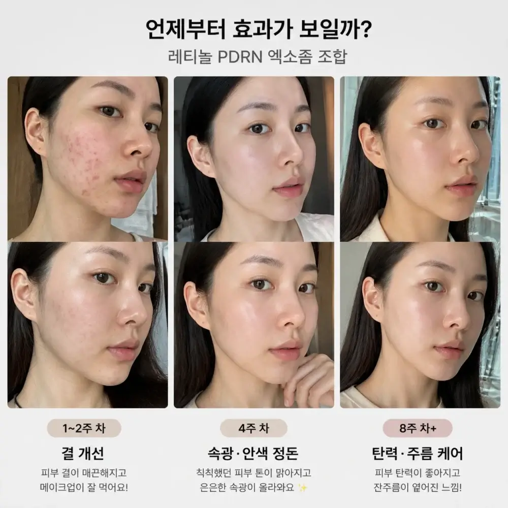 레티놀 PDRN 엑소좀 조합 사용 기간에 따른 피부결 안색 탄력 주름의 단계별 개선 과정